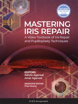 cover image of Mastering Iris Repair